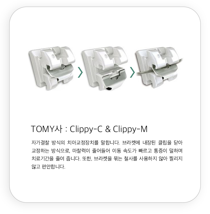 TOMY사 : Clippy-C