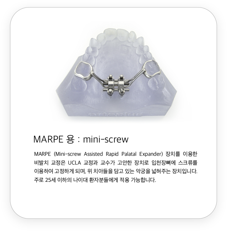 MARPE 용 : mini-screw
